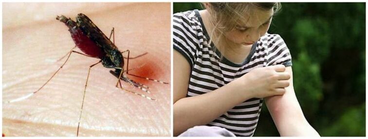 Nódulos dolorosos após uma picada de mosquito podem ser um sintoma de dirofilariose