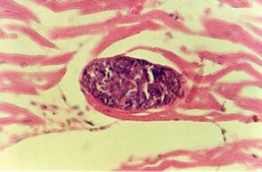 Parasita