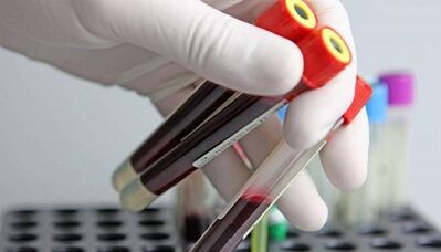 Como fazer testes para parasitas no corpo