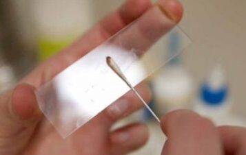 Que testes devem ser realizados para parasitas