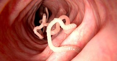 As causas dos parasitas no corpo humano