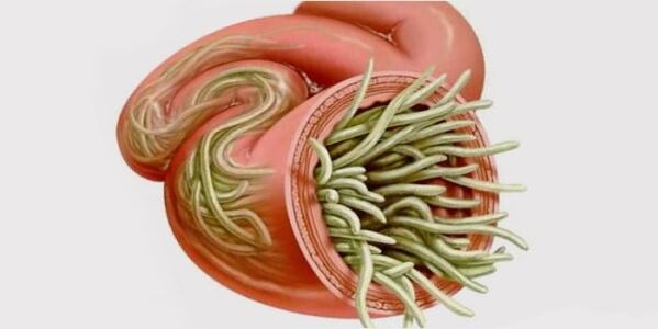 vermes em humanos