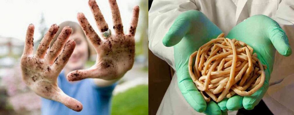 Os parasitas podem entrar no corpo através das mãos sujas