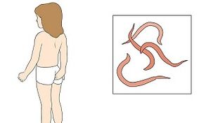 sintomas da presença de parasitas no corpo humano