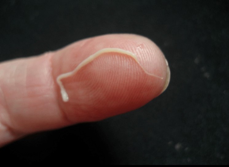 parasita de lombriga do corpo humano